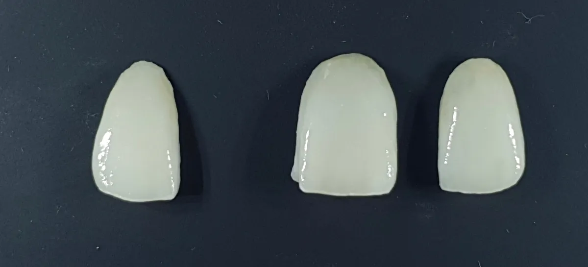 Tre faccette in ceramica di disilicato prima dell'applicazione, su sfondo scuro